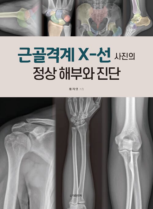 근골격계 X-선 사진의 정상 해부와 진단